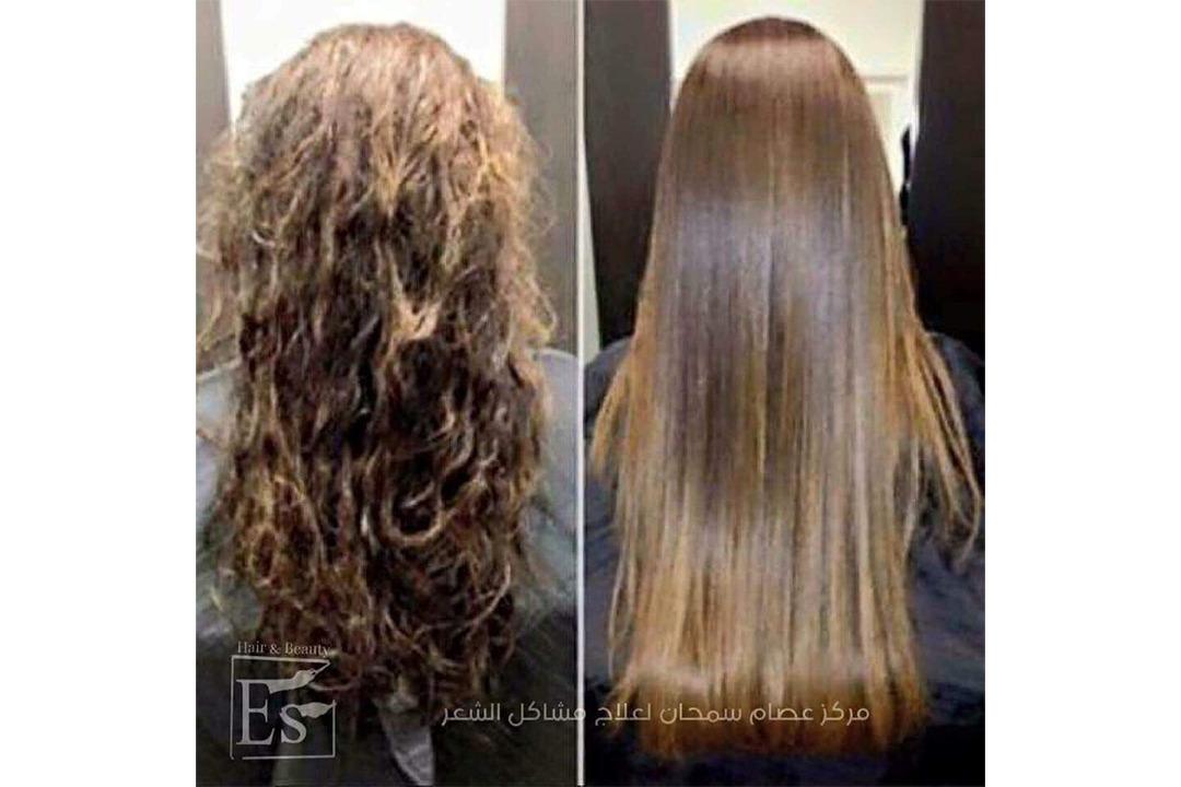 مركز و صالون عصام سمحان لعلاج مشاكل الشعر photo 6