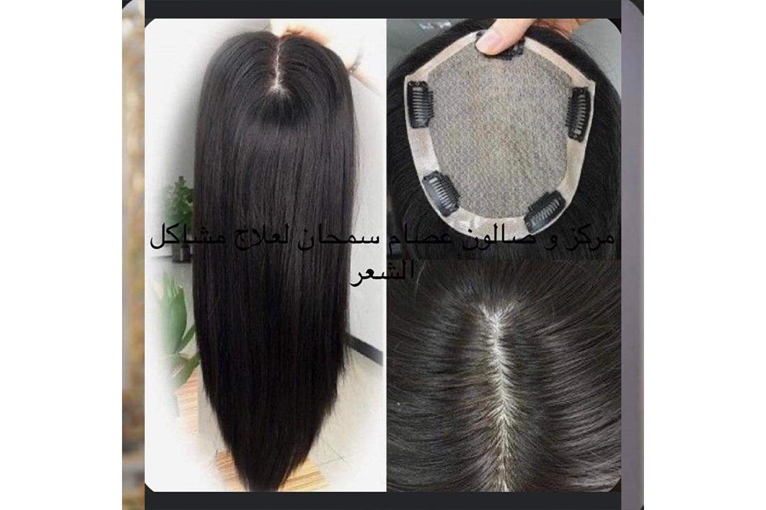 مركز و صالون عصام سمحان لعلاج مشاكل الشعر photo 5
