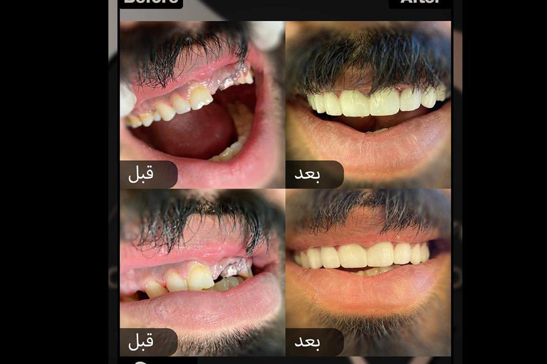 عيادة د. مهند الأسود للأسنان photo 2