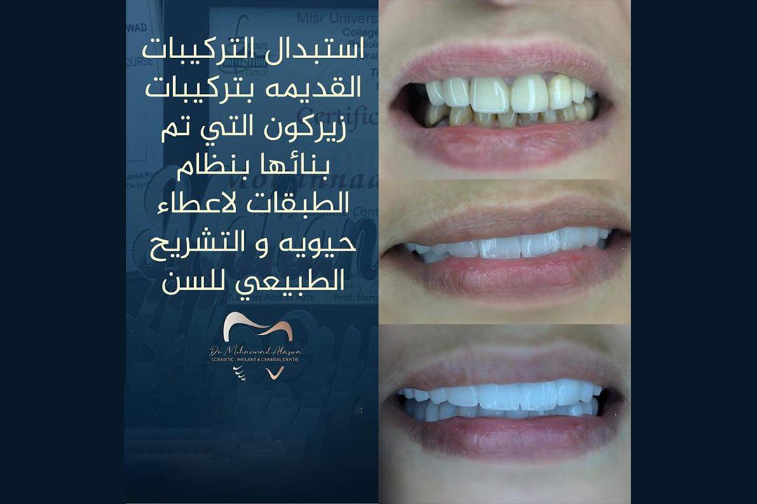 عيادة د. مهند الأسود للأسنان photo 3