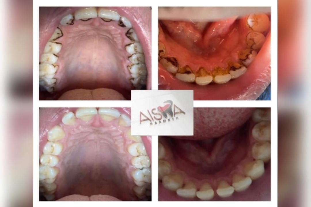 Dr. Ahed Hasan Al-Fasfous photo 5