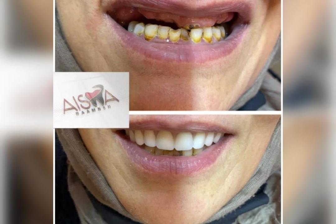 Dr. Ahed Hasan Al-Fasfous photo 4