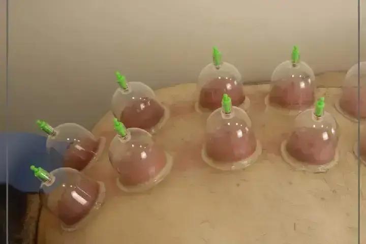 مركز طريق الشفاء للعلاج الطبيعي photo 1