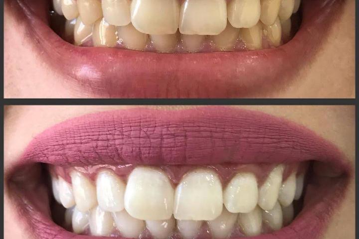 Whity Dental Care photo 3